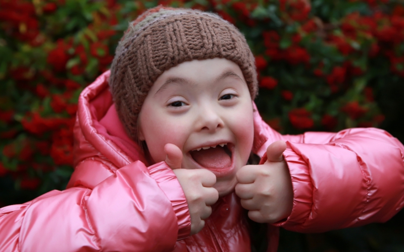 Osaatko kohdata ihmisen, jolla on downin syndrooma? Tee testi - Ilmiöt