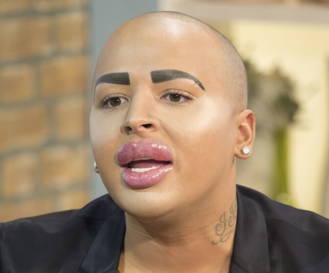 ”Huulikuningas” Jordan James Parke on kuollut