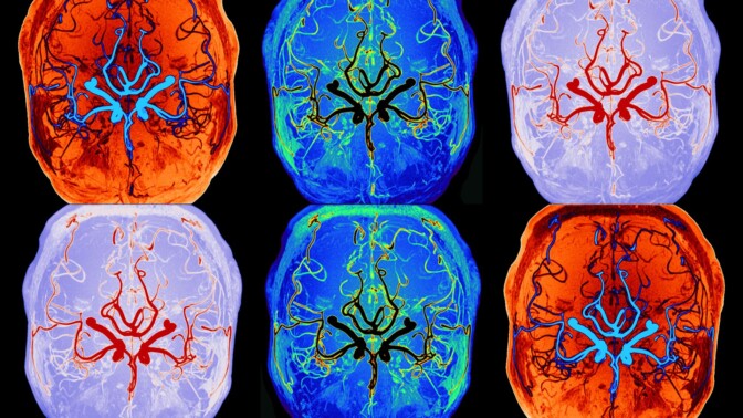 Näin aivot puhdistuvat – suomalaiskeksintö mittaa toimintoa