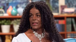 Valkoihoisena syntynyt kohumalli Martina Big on nykyään täysin eri näköinen – uskomaton kuvapari esittelee muutosta