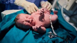 ”Energiajuomavauvat” ovat huolestuttavasti yleistyvä ilmiö – synnytysosasto reagoi