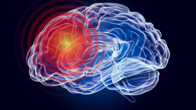 Äkillinen aivovaurio koskettaa jopa miljoonaa suomalaista – oireet eivät aina näy päällepäin